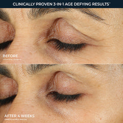 RETINOL CORREXION® Line Smoothing Eye Cream