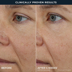 RETINOL CORREXION® Line Smoothing Triple Serum