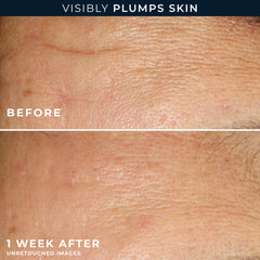 Hydration+ Serum Capsules