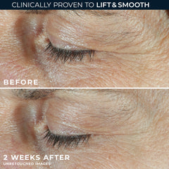 DERM CORREXION® Dual Eye Cream