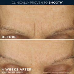 Pure RoC® Retinol Starter Set
