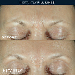 DERM CORREXION® Fill + Treat Serum