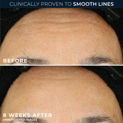 RETINOL CORREXION® Line Smoothing Night Serum Capsules