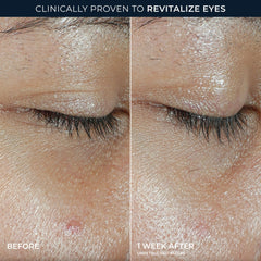 MULTI CORREXION® Revive + Glow Eye Balm