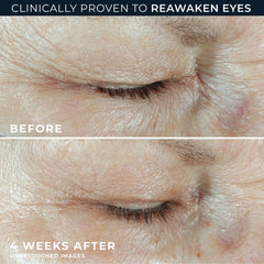 Hydration+ Eye Cream
