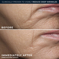 RETINOL CORREXION® Deep Wrinkle Rich Cream