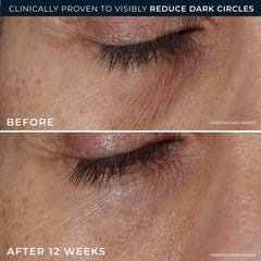 DERM CORREXION® Eye Repair Dark Circle Cream