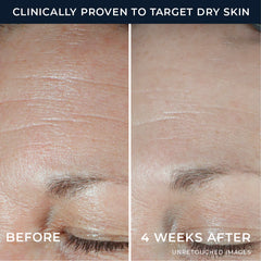 Hydration+ Moisturizer